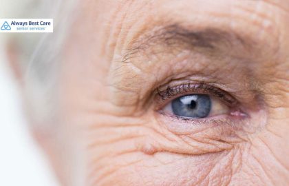 Navigating Glaucoma: Living Your Best Life