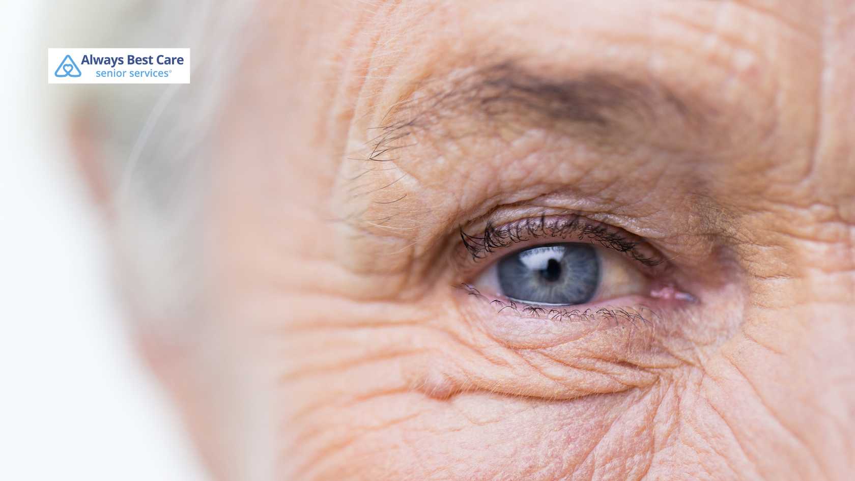 Glaucoma Care: Strategies for Better Living