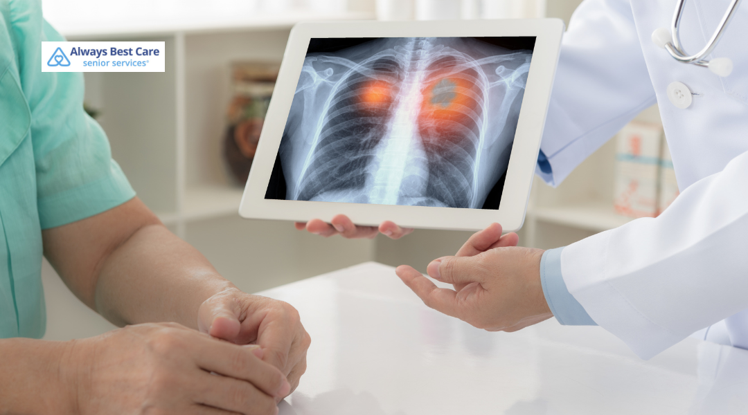 How Home Care Supports Argyle Seniors Undergoing Lung Cancer Treatment