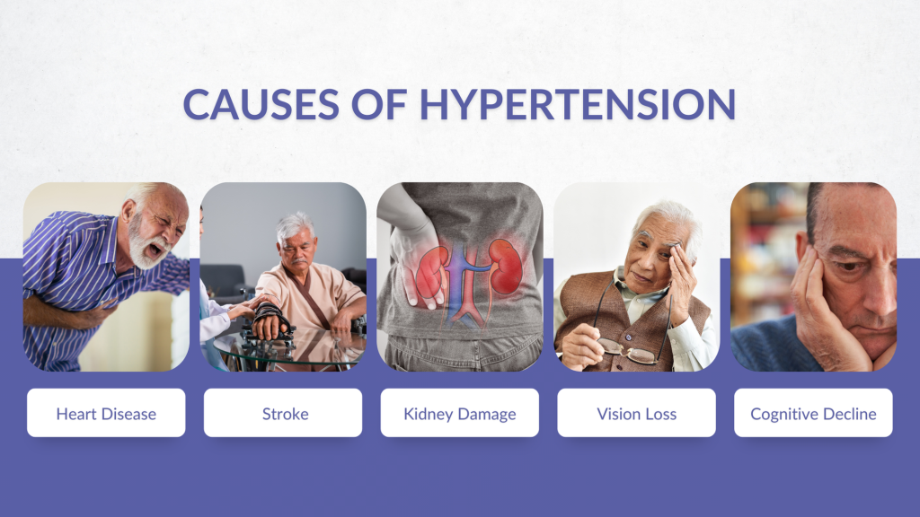 CAUSES OF HYPERTENSION