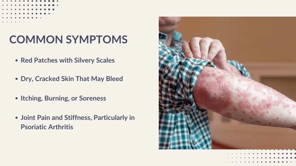 RECOGNIZING THE SYMPTOMS