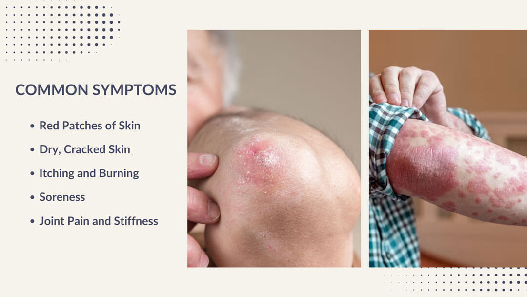 common symptoms