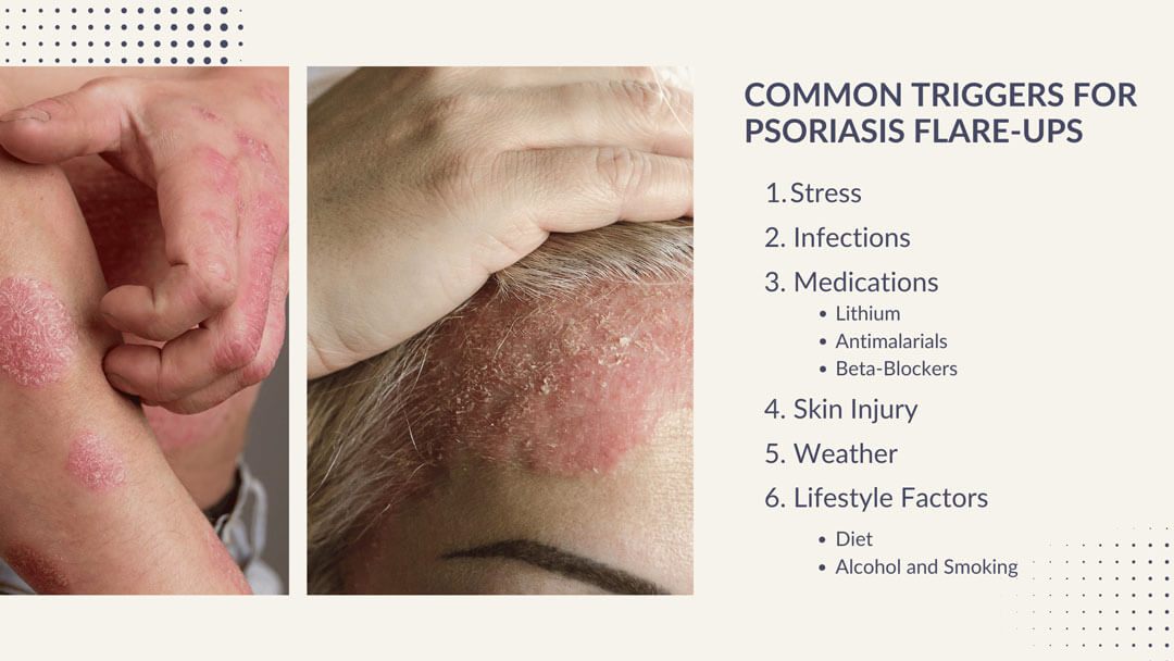 Common-Triggers-for-Psoriasis-Flare-Ups