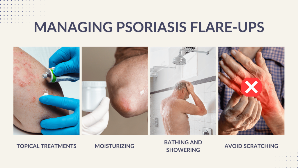 MANAGING PSORIASIS FLARE UPS