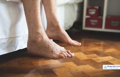 On Your Feet: Common Foot Problems for Seniors