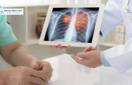 How Home Care Supports Palm Desert Seniors Undergoing Lung Cancer Treatment