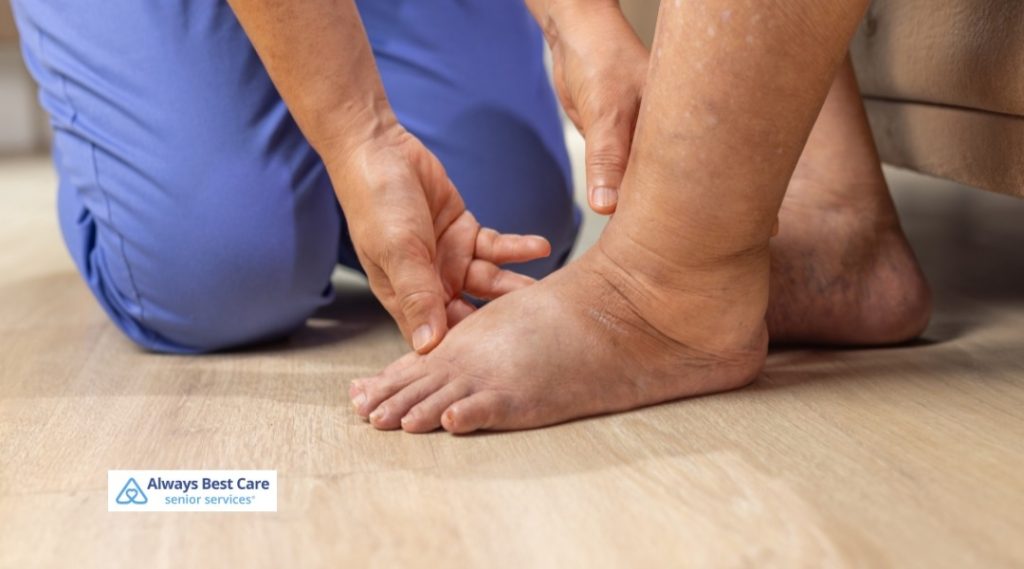 Caregiver assisting a senior with swollen feet, ensuring proper foot care.
