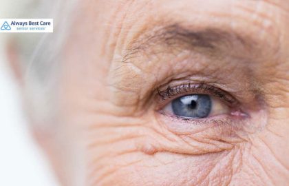 Steps to Thrive While Living with Glaucoma