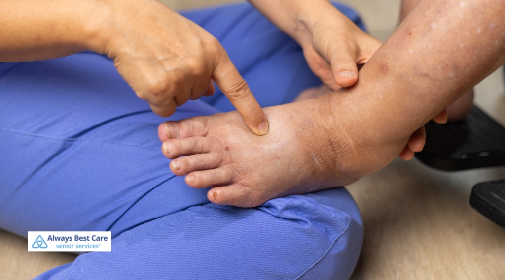 Caregiver pointing to a tender spot on a senior’s swollen foot, emphasizing the need for timely podiatric care.