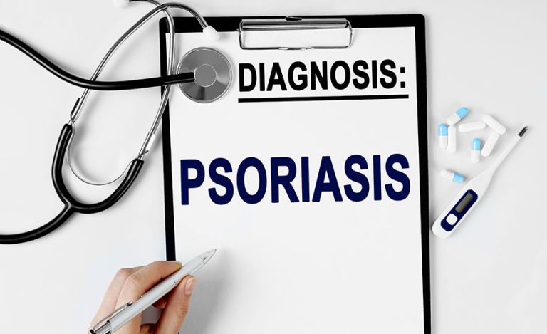 Understanding And Managing Psoriasis Always Best Care Senior Services 