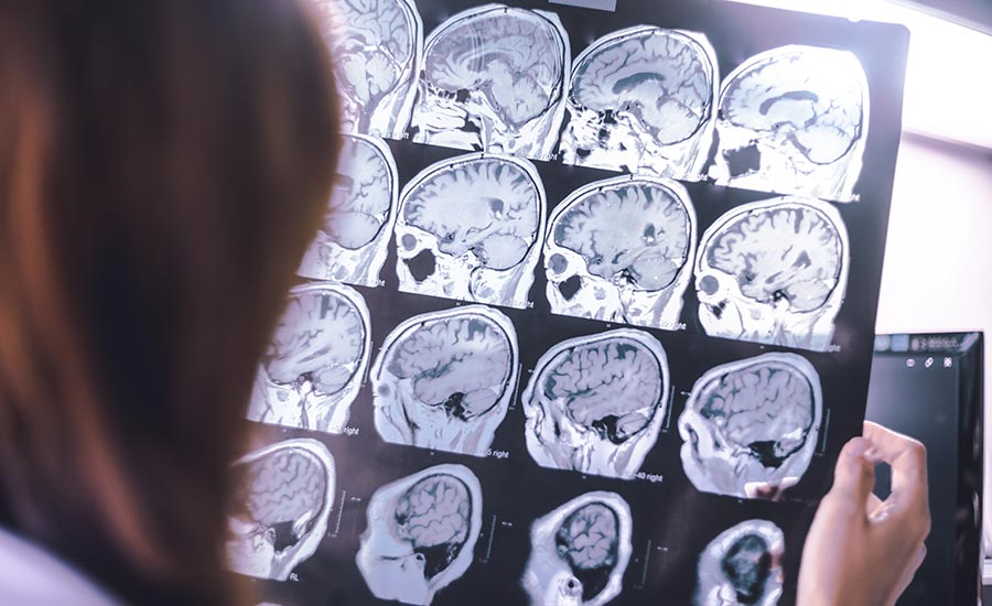 A doctor holding a brain scan​