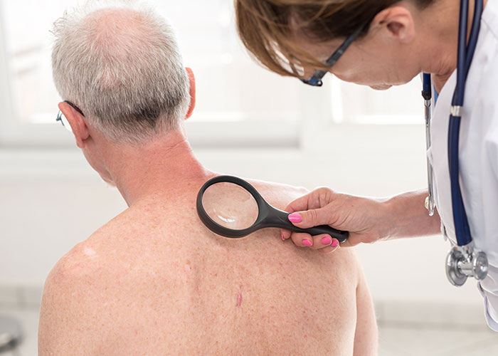 Always Best Care Highlights Summer Skin Cancer Prevention